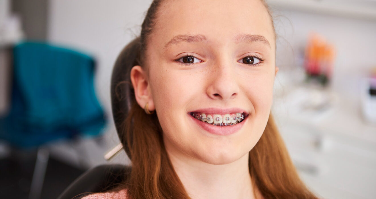 Σιδεράκια για εφήβους: τι πρέπει να γνωρίζουν γονείς και παιδιά