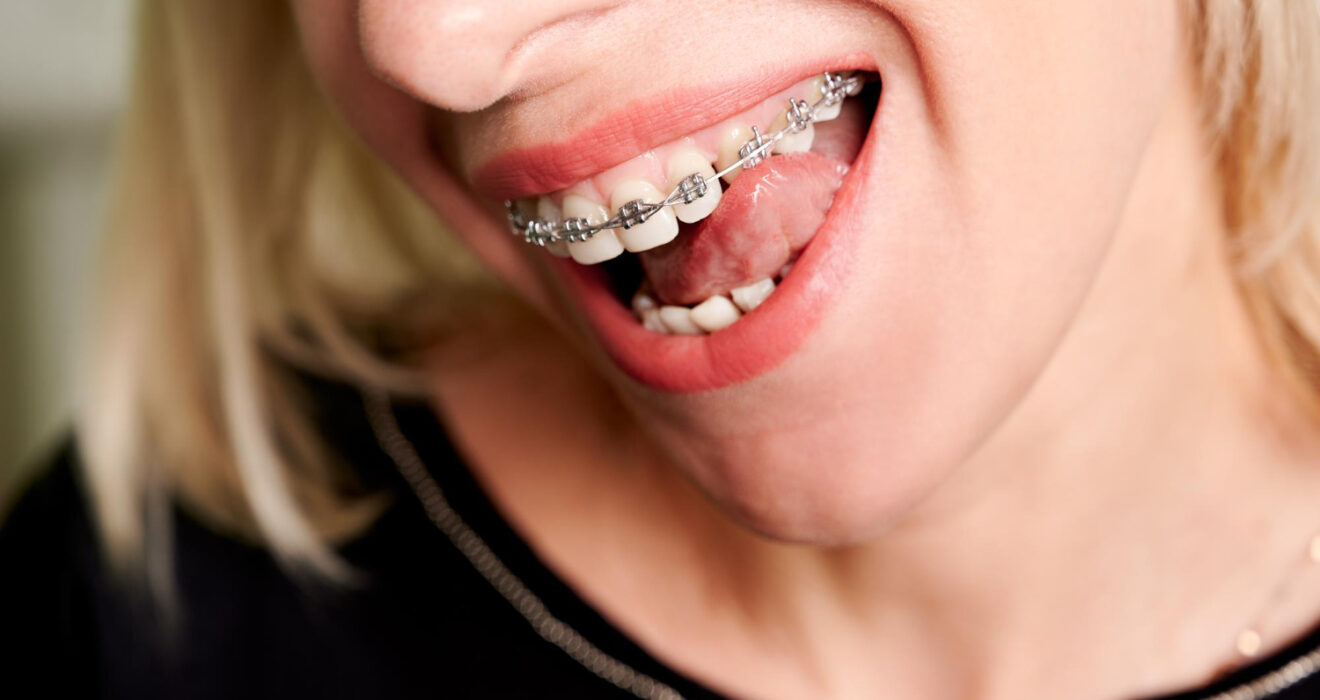 Συχνά λάθη στη φροντίδα των σιδερακίων