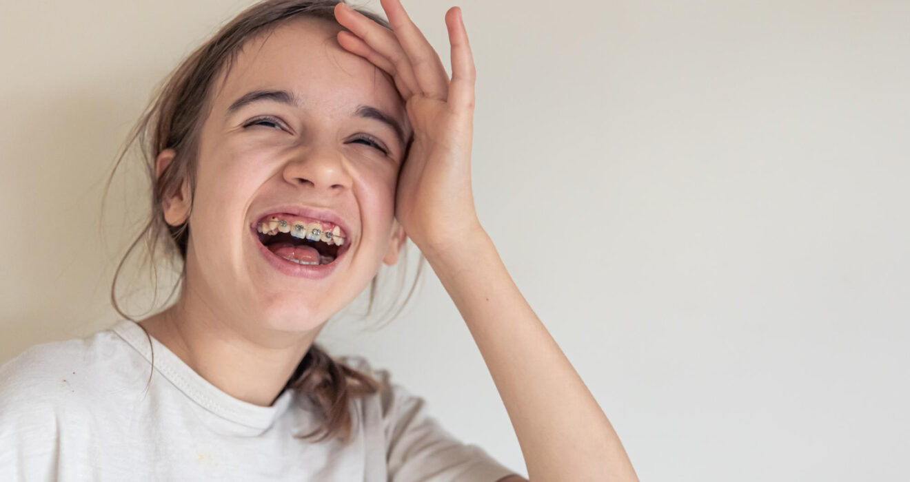 Διατροφή για εφήβους με σιδεράκια: πρακτικές συμβουλές